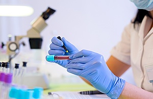 Healthcare worker marking blood vial in laboratory