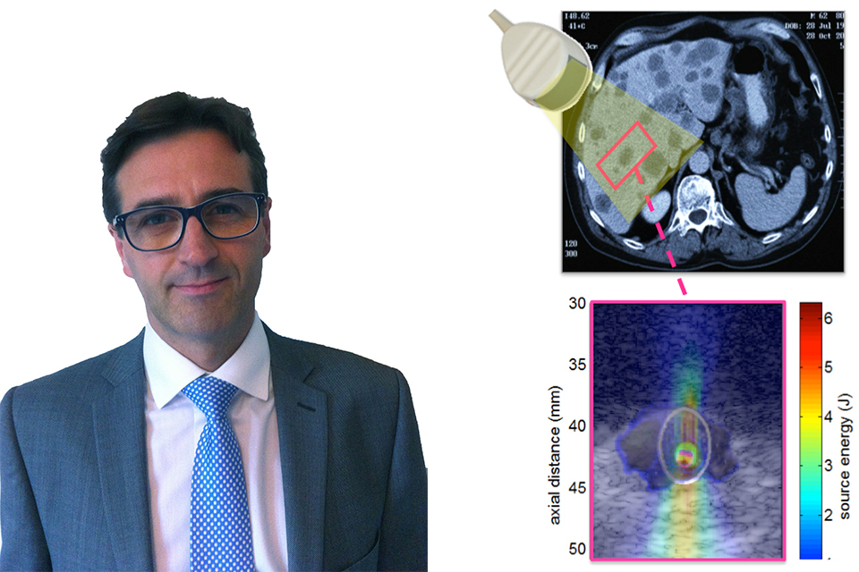 New case study illustrates how MHRA and OxSonics help cancer drugs to go the extra mile