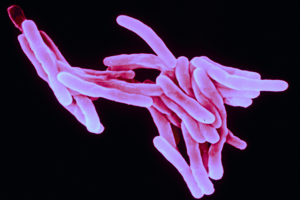 UK calls for international action on antimicrobial resistance