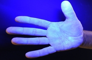 Bacteria highlighted on a hand