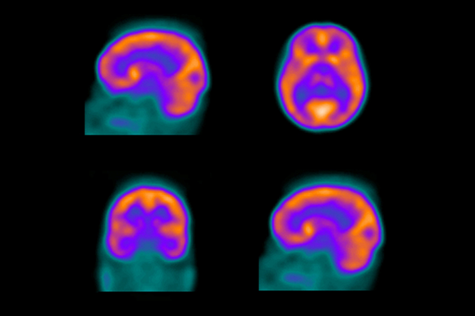 CMA applies discretion not to refer IBA/Mallinckrodt merger