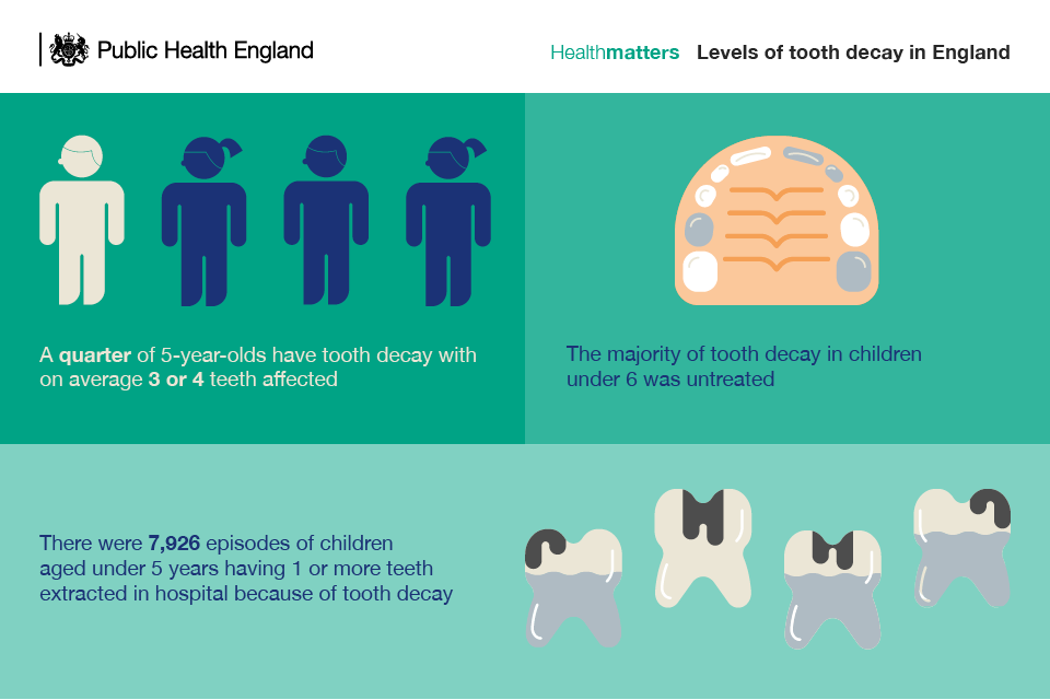 Infographic showing levels of tooth decay in England
