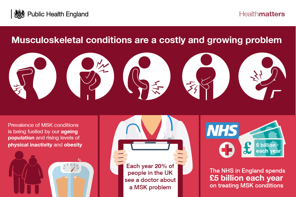 Infographic showing the prevalence and cost of MSK conditions