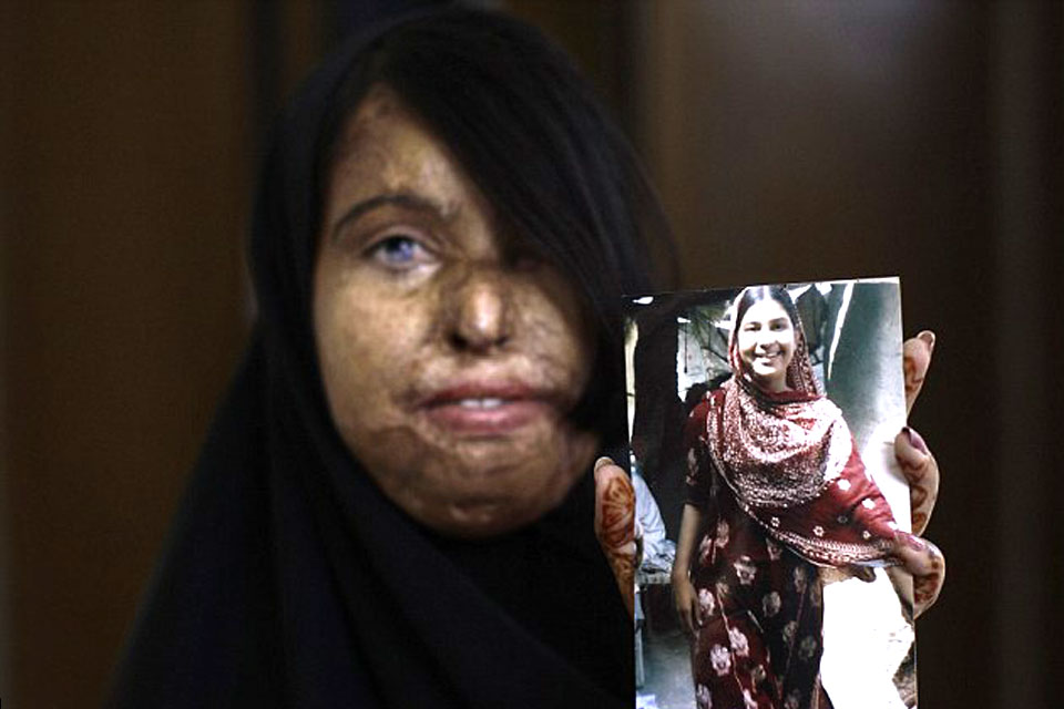 Naila shows a picture of herself before the acid attack. Picture: Acid Survivors Foundation