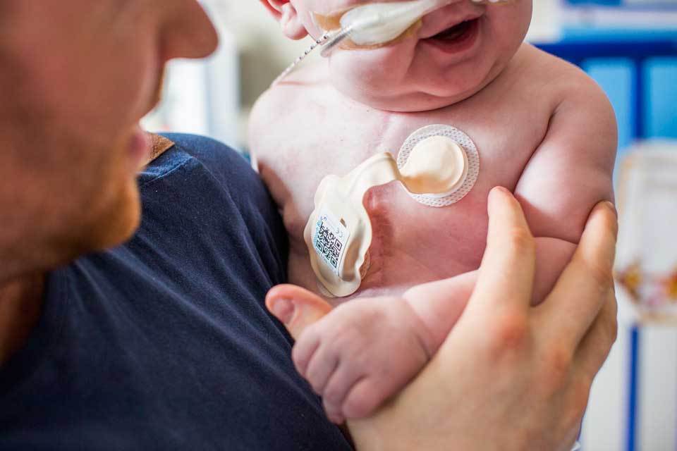 Isansys: wireless technology helps to save children’s lives
