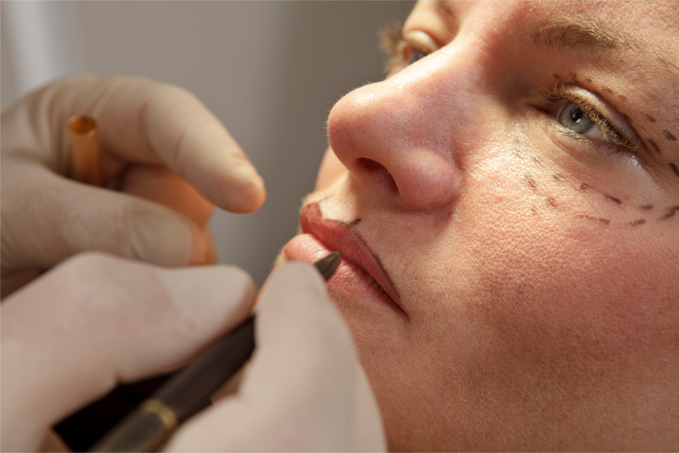 Recommendations to protect people who choose cosmetic surgery