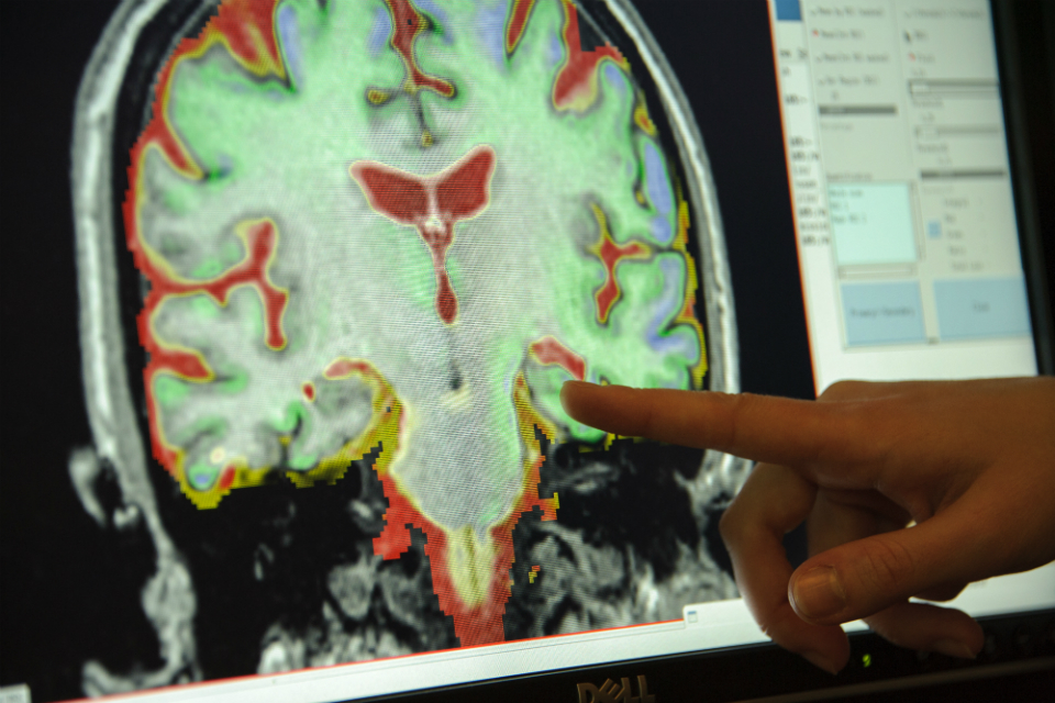 UK commits to new action to find breakthrough on dementia