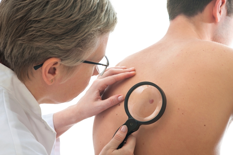 Over 500 UK patients gain early access to new melanoma treatment