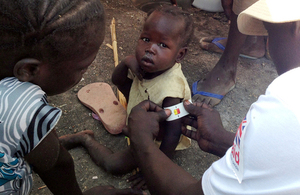 A child is checked for signs of malnutrition in South Sudan. Picture: Nick Stanton/International Medical Corps