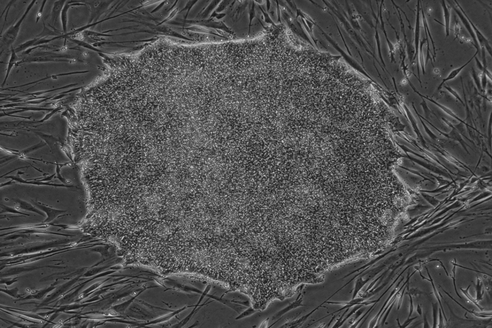 ‘Regulator ready’ stem cell lines now available for clinical development