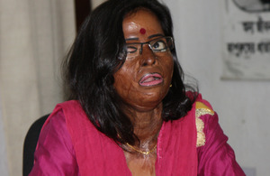 Hasina - an acid attack survivor. Picture: Narayan Debnath/DFID