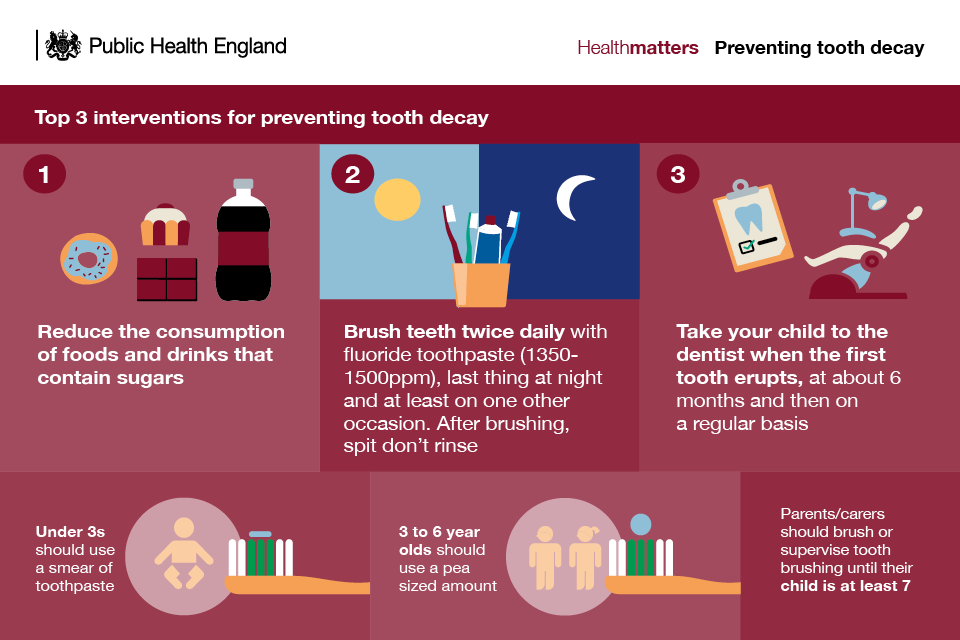 Infographic showing the top 3 interventions for preventing tooth decay