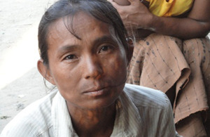 Daw Thi May Oo, resident of Ohn Taw village, no longer has to walk miles each day for water thanks to Merlin and UK aid. Picture: Merlin