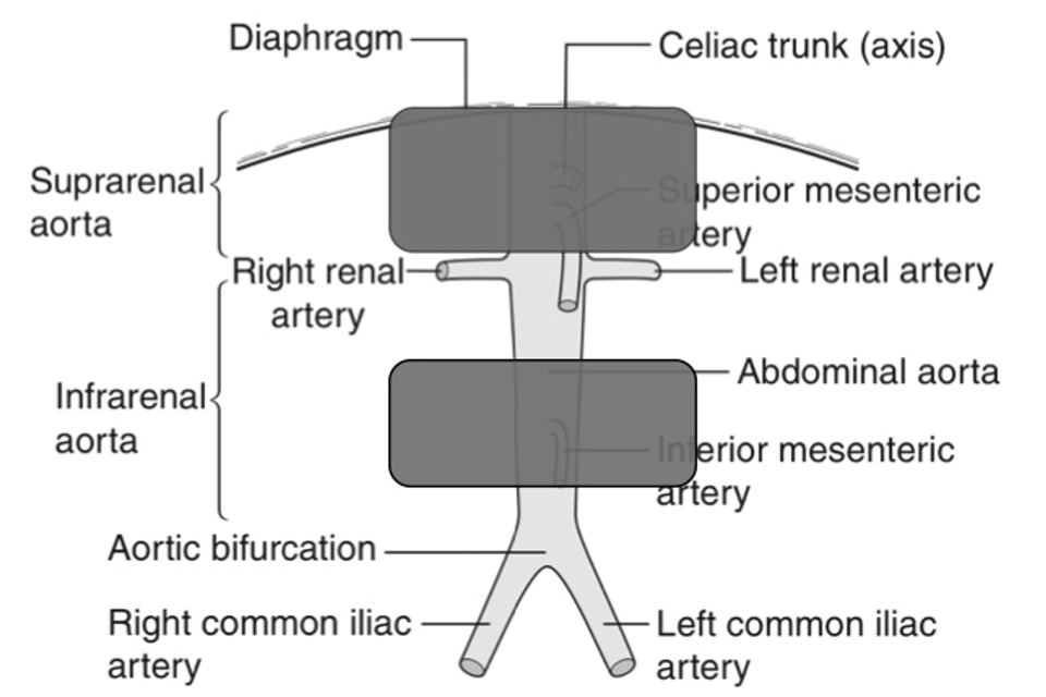 Non-visualisation of the supra and infrarenal abdominal aorta