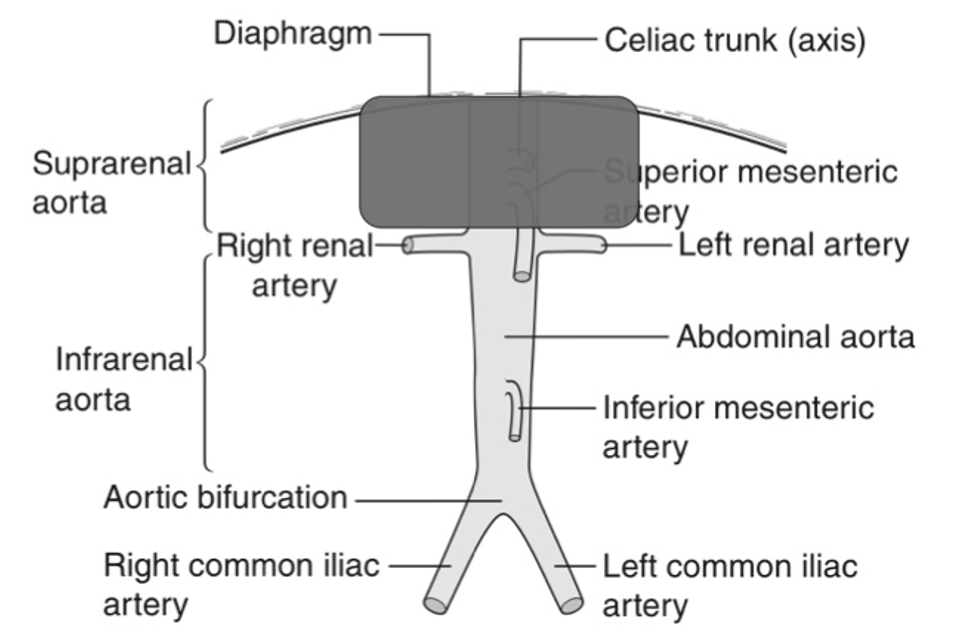 Non-visualisation of supra-renal aorta