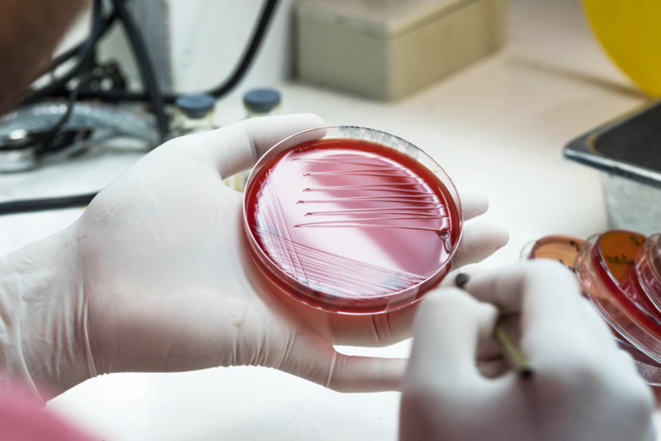 Tackling antibiotic resistance in China: apply for business funds