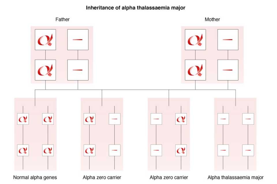 Inheritance of alpha thalassaemia major