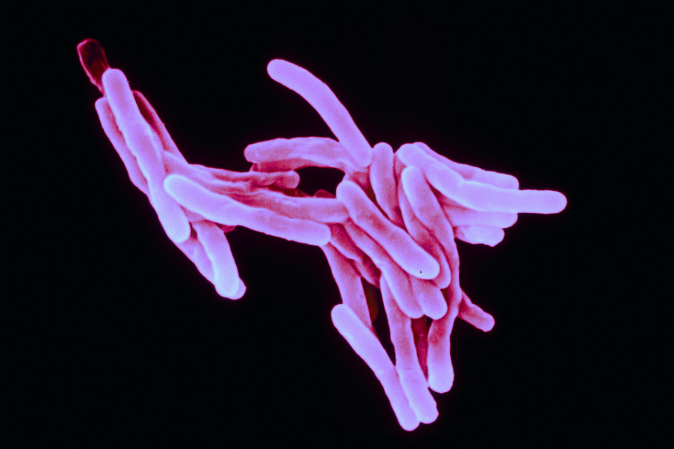 £10 million research competition launched to tackle antimicrobial resistance