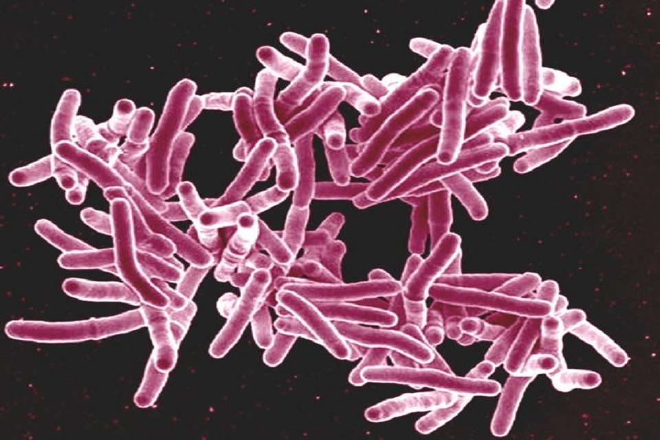 New study shows positive impact of genetic code on TB treatment - GOV.UK