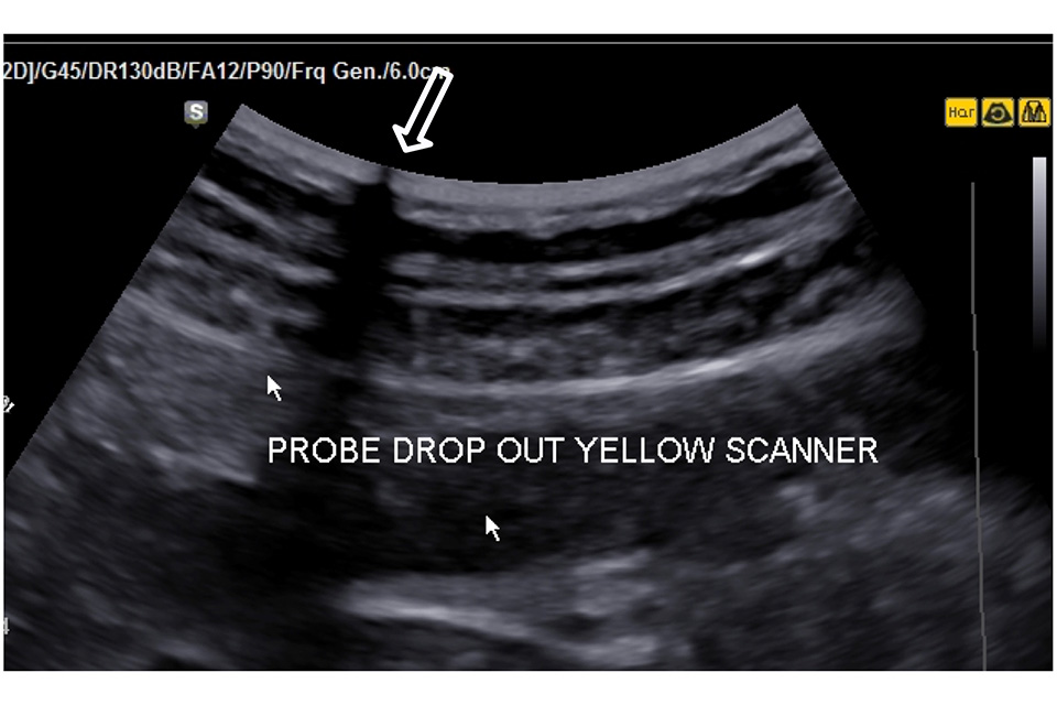 Screen shot of an ultrasound image. Words across the middle of the screen read: 'Probe drop out yellow scanner'. Large arrow at top of screen points to area where there is a transducer transmission fault 