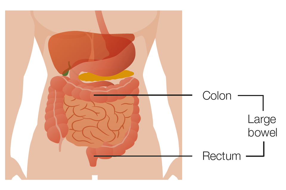 Diagram showing colon and rectum making up the large bowel