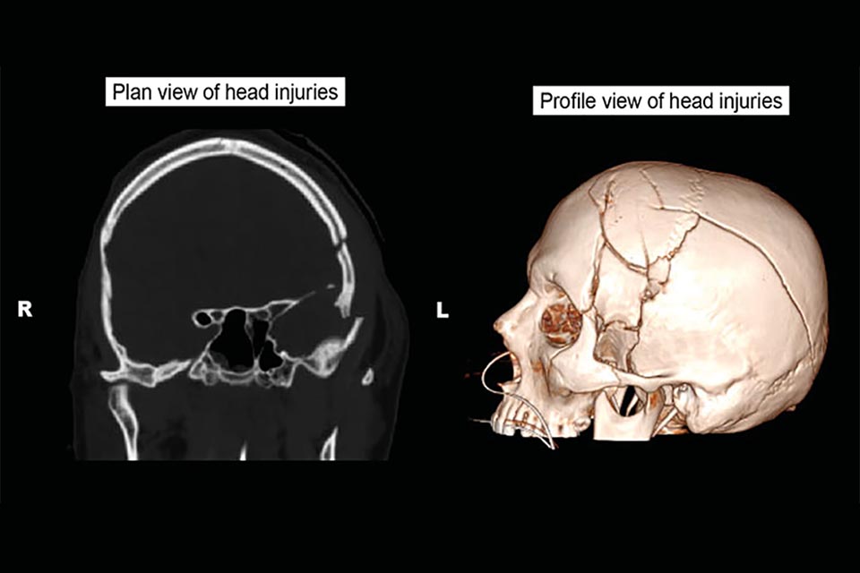 Medical imagery showing extent of head injuries