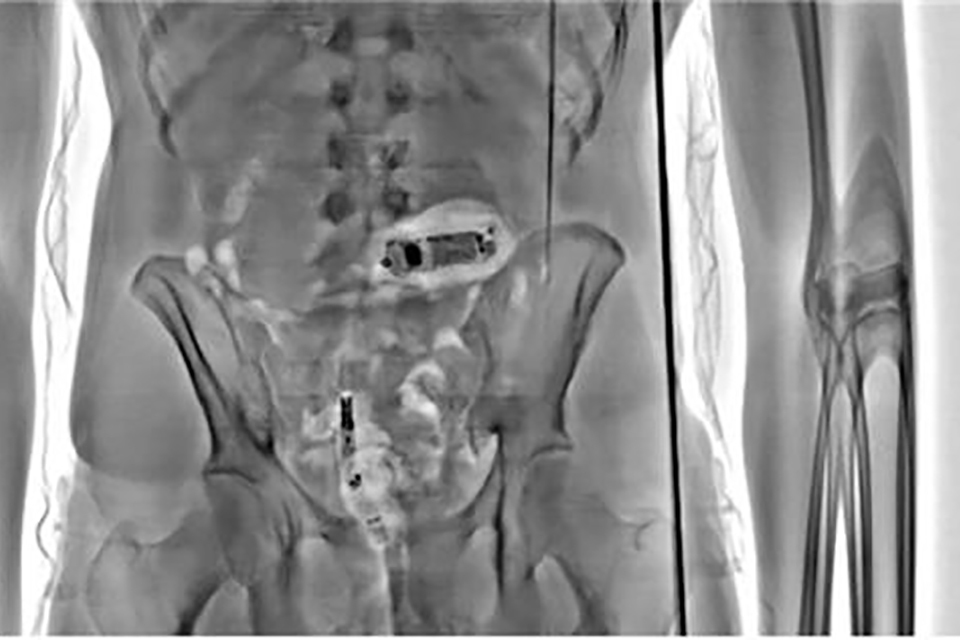 X ray scanners stop over 1,000 illegal items entering prisons