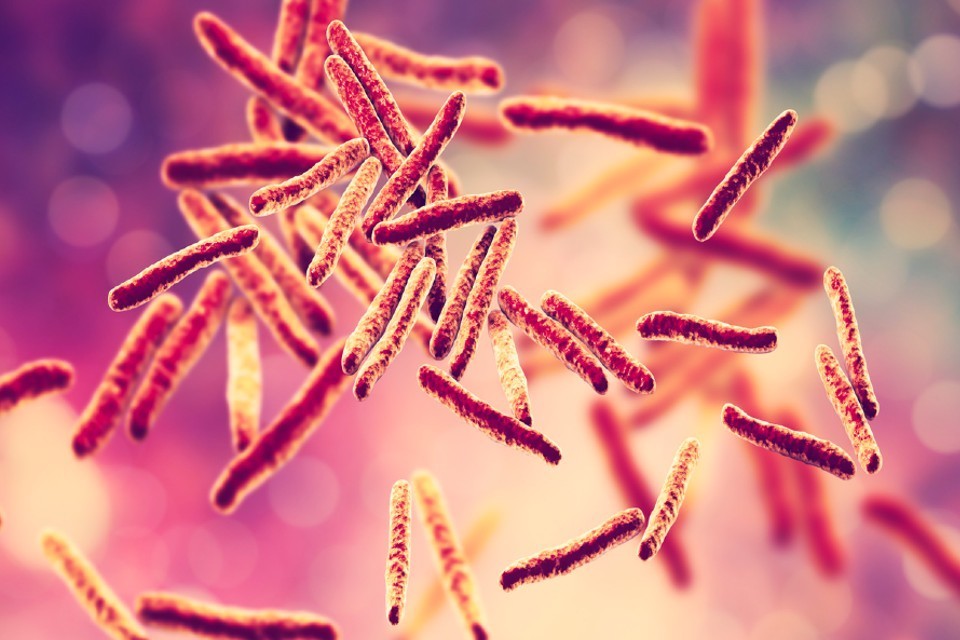 UKHSA calls for a renewed effort to tackle TB - GOV.UK