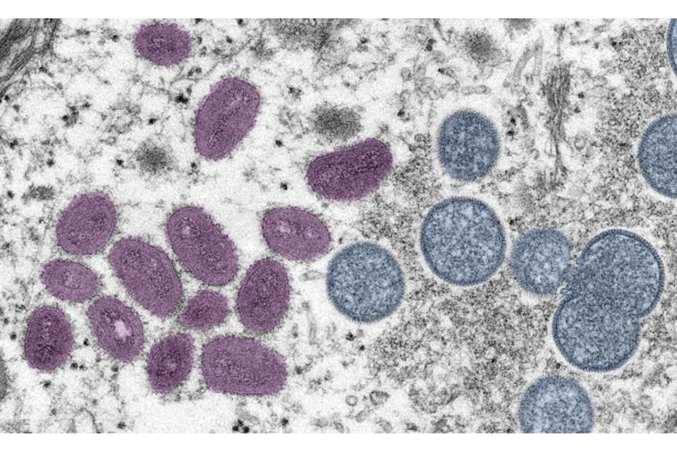 UK monkeypox case numbers begin to plateau