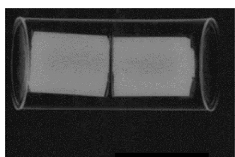 Older film type radiograph