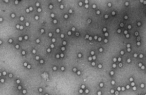 Electron micrograph of AAV viral particles