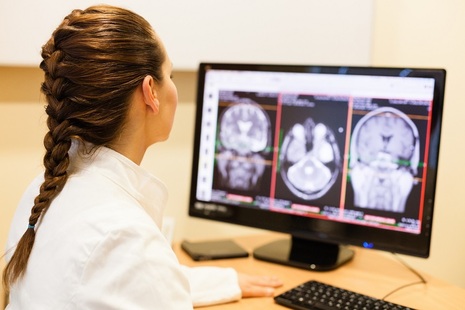Доктор анализирует МРТ головного мозга