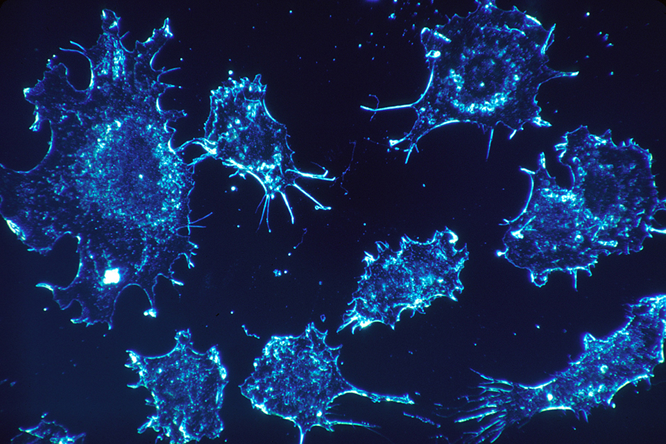 NHS red tape blitz delivers game-changing new cancer treatment