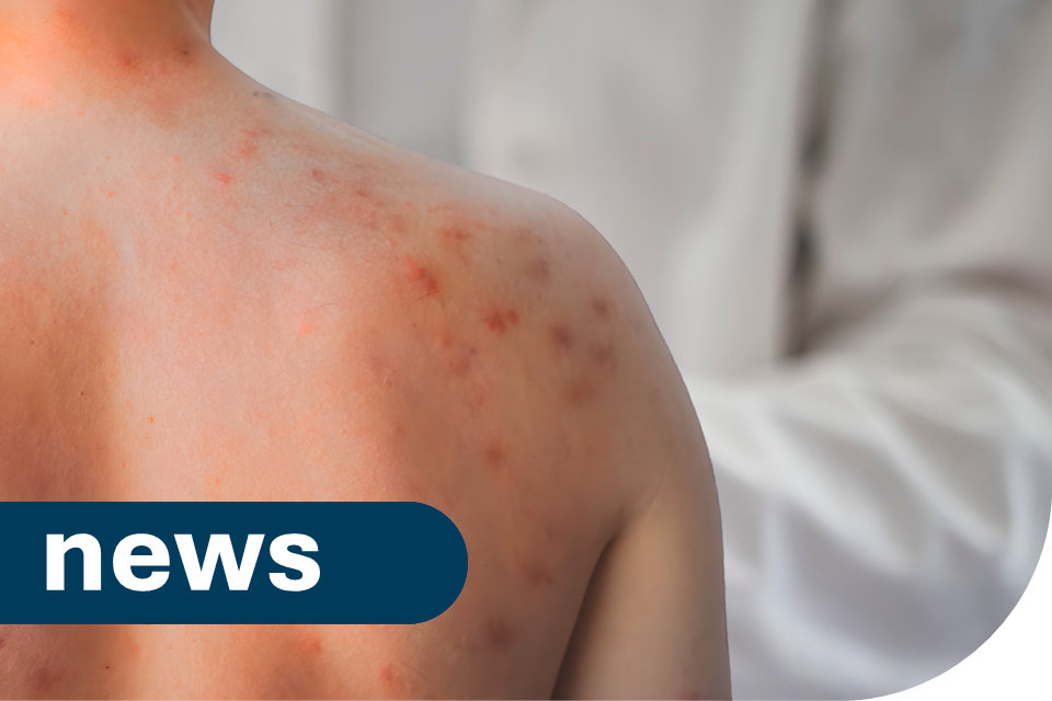 Latest measles figures published as two deaths confirmed in 2026