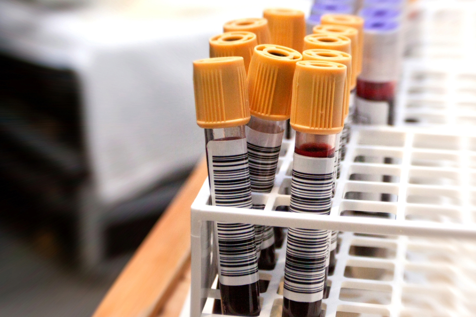 MHRA safety review gives UK plasma donations go ahead
