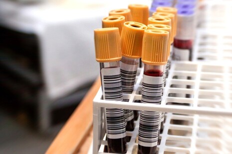 Blood in test tubes.